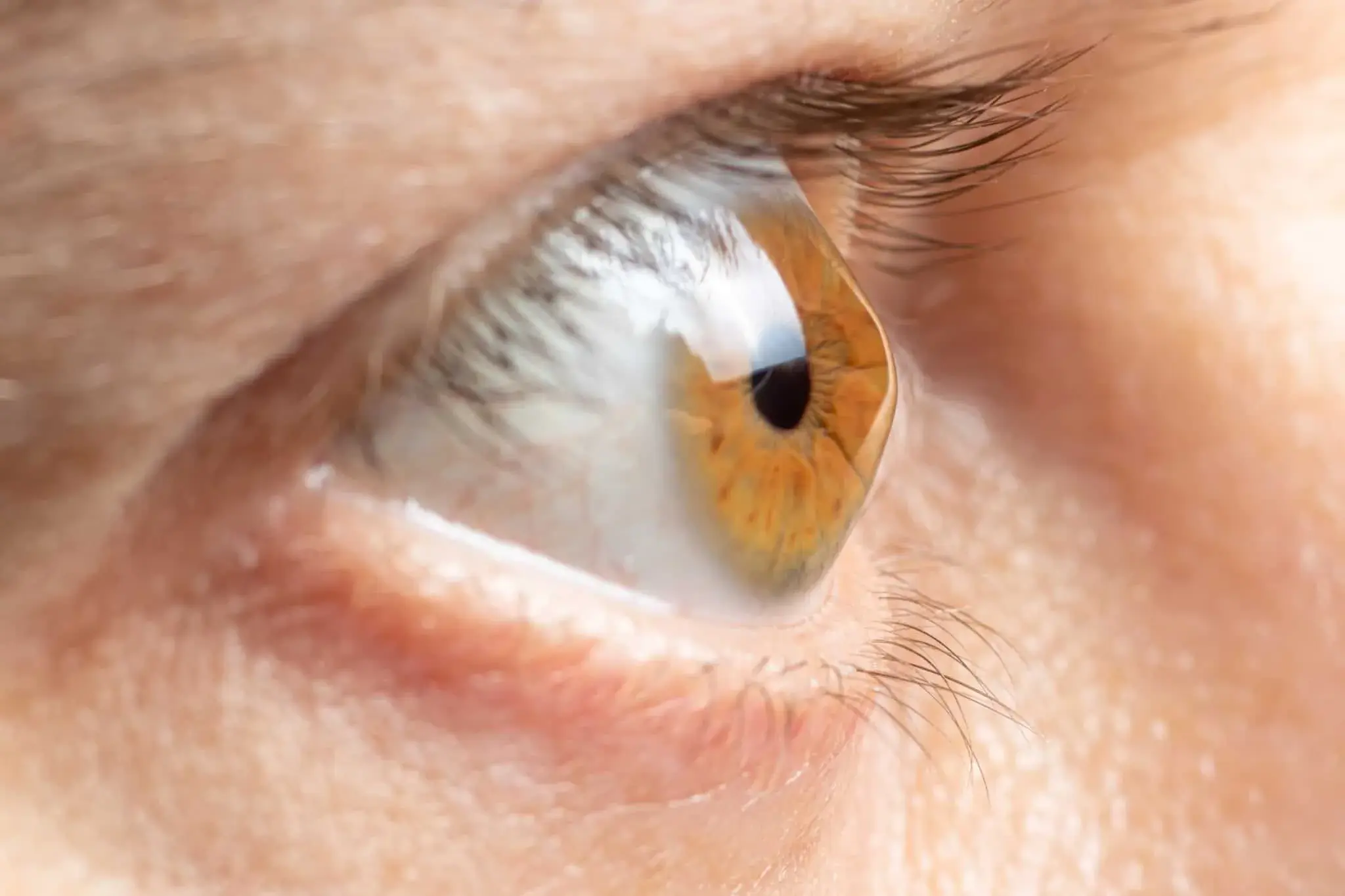 Close-up of a human eye with brown irises and clear cornea.