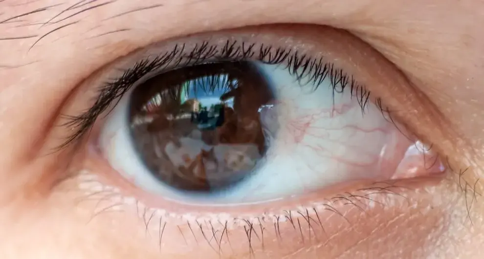 Close-up of a human eye reflecting surroundings, with visible blood vessels.