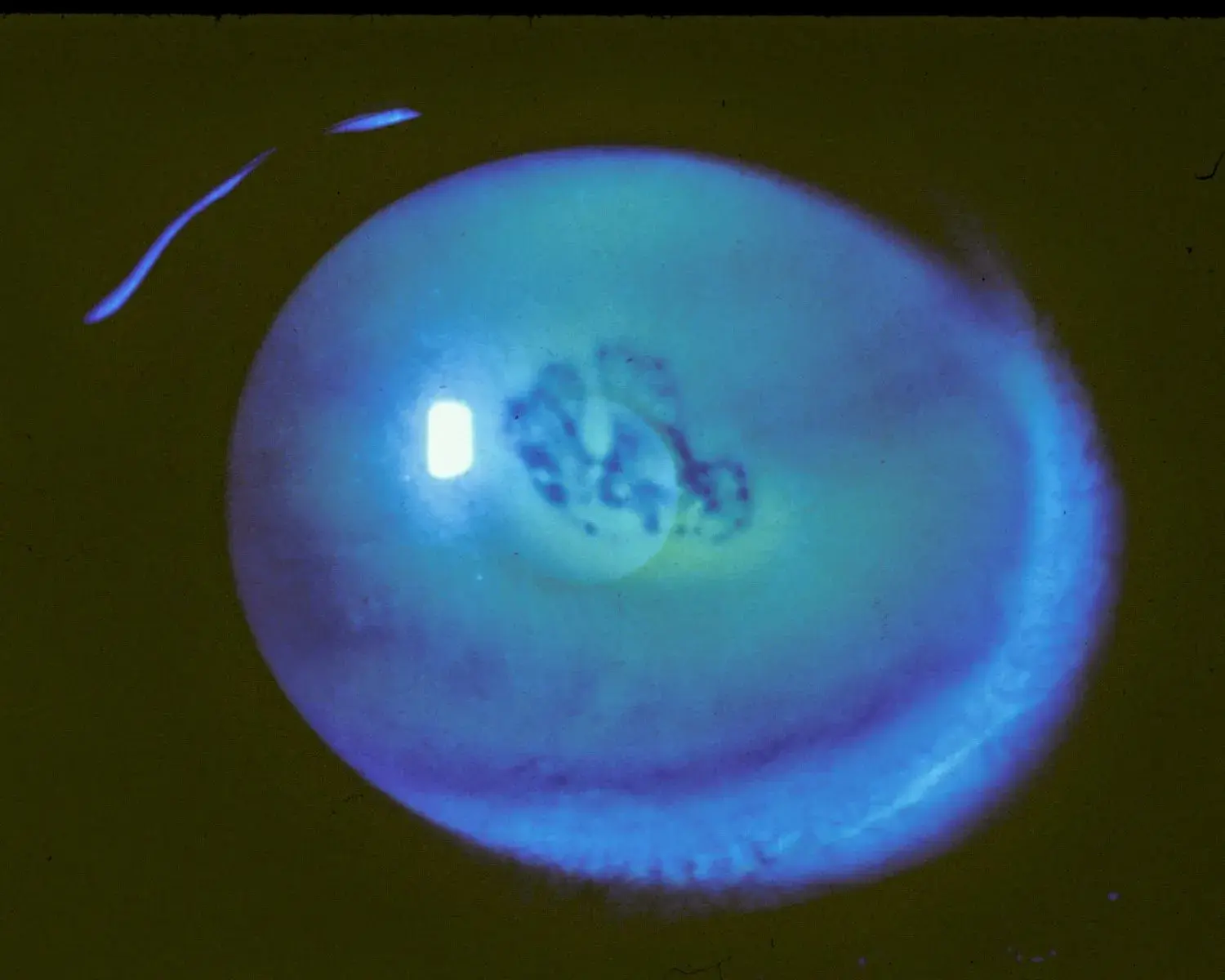 Close-up of a cornea under UV light showing erosion patterns.