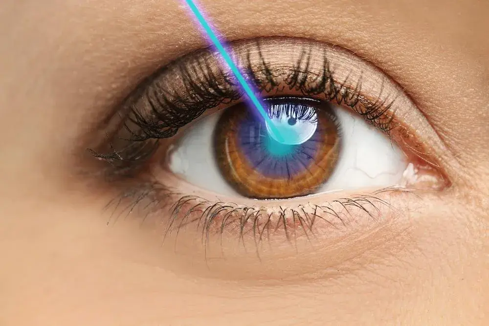 Close-up of a brown eye undergoing a laser treatment.