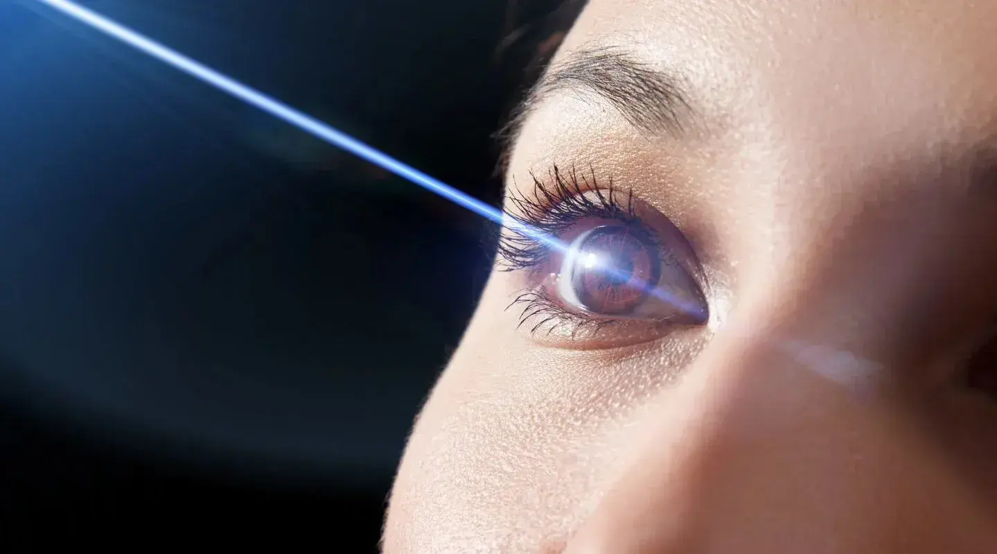 Close-up of an eye undergoing laser treatment for keratoconus.