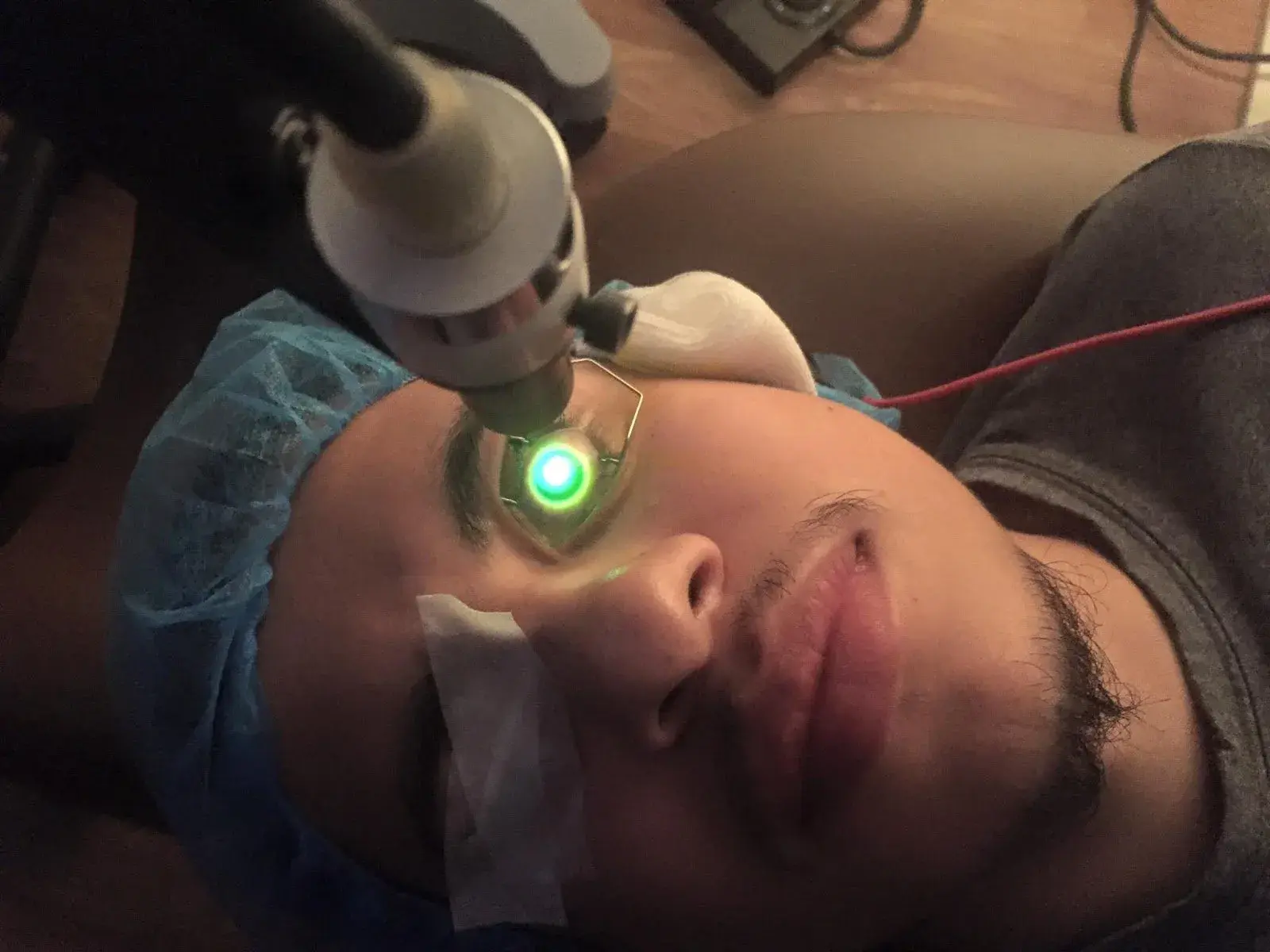 Patient receiving laser treatment for keratoconus.