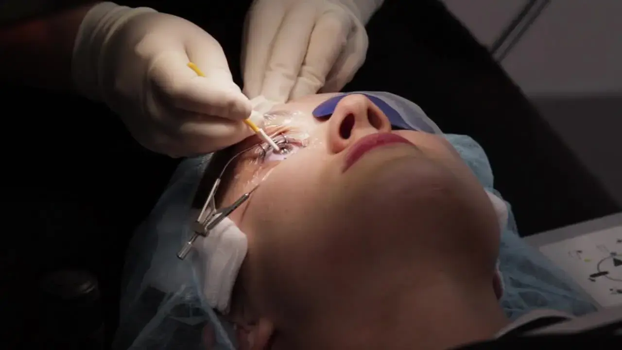 Patient undergoing PRK eye surgery with a medical professional's hands working on the eye.